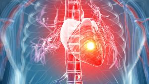 Biologic Drugs Lessen Artery Plaque Build-up In People With Chronic Inflammation
